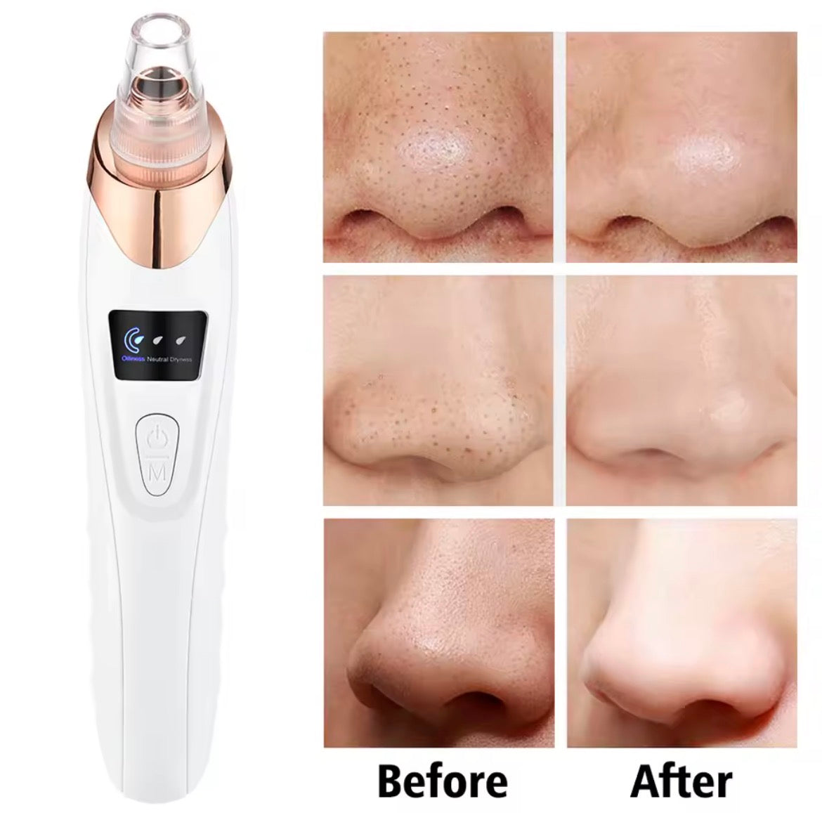 3 Suction Mode Blackhead Remover Face Cleansing Beauty Machine Dead Skin Remover Face Vacuum Blackhead Removal Skin Care Tool