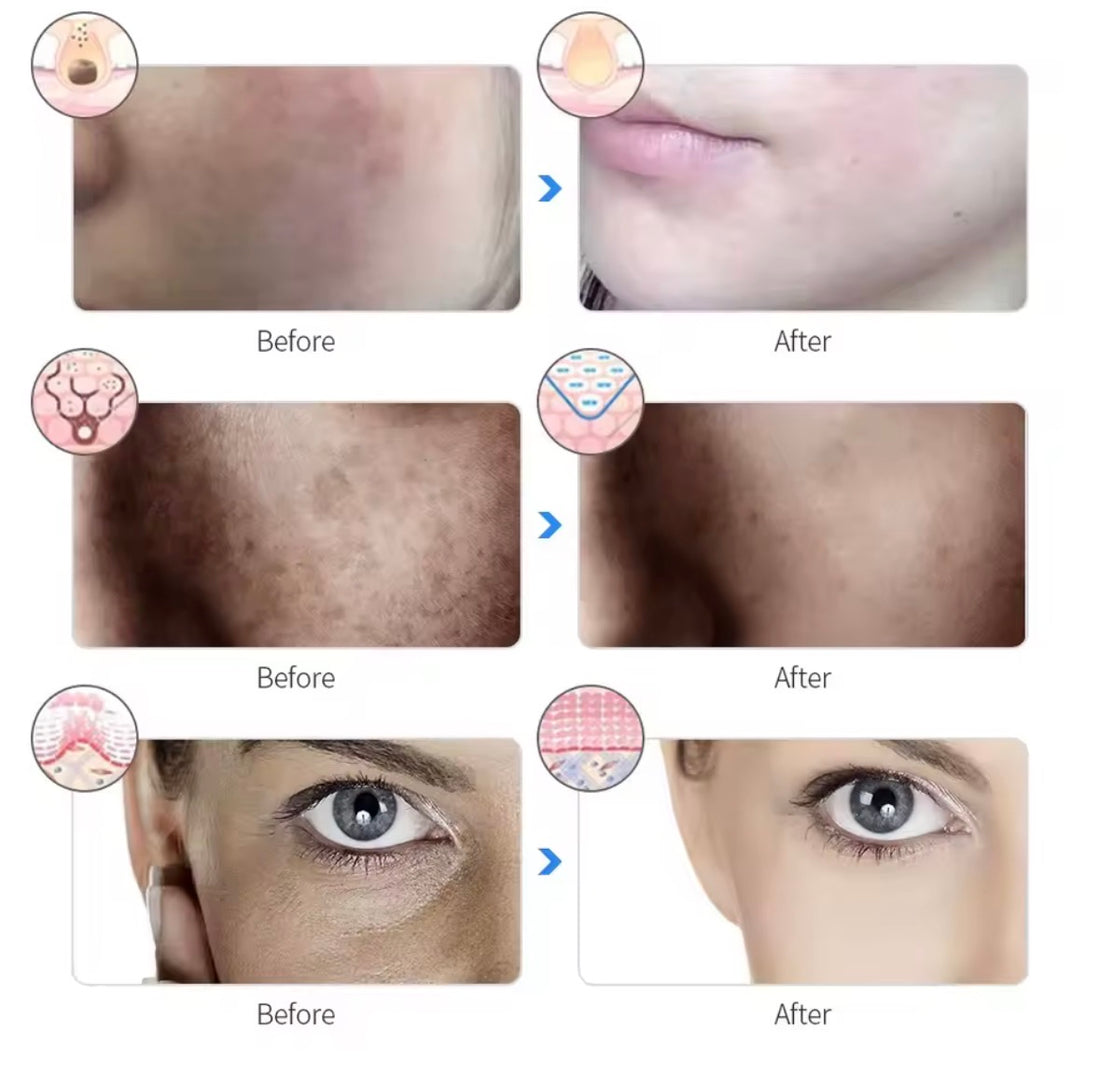 7 Colors Facial LED Mask