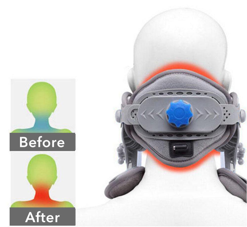 Veridz™ Advanced Heated Cervical Traction Device