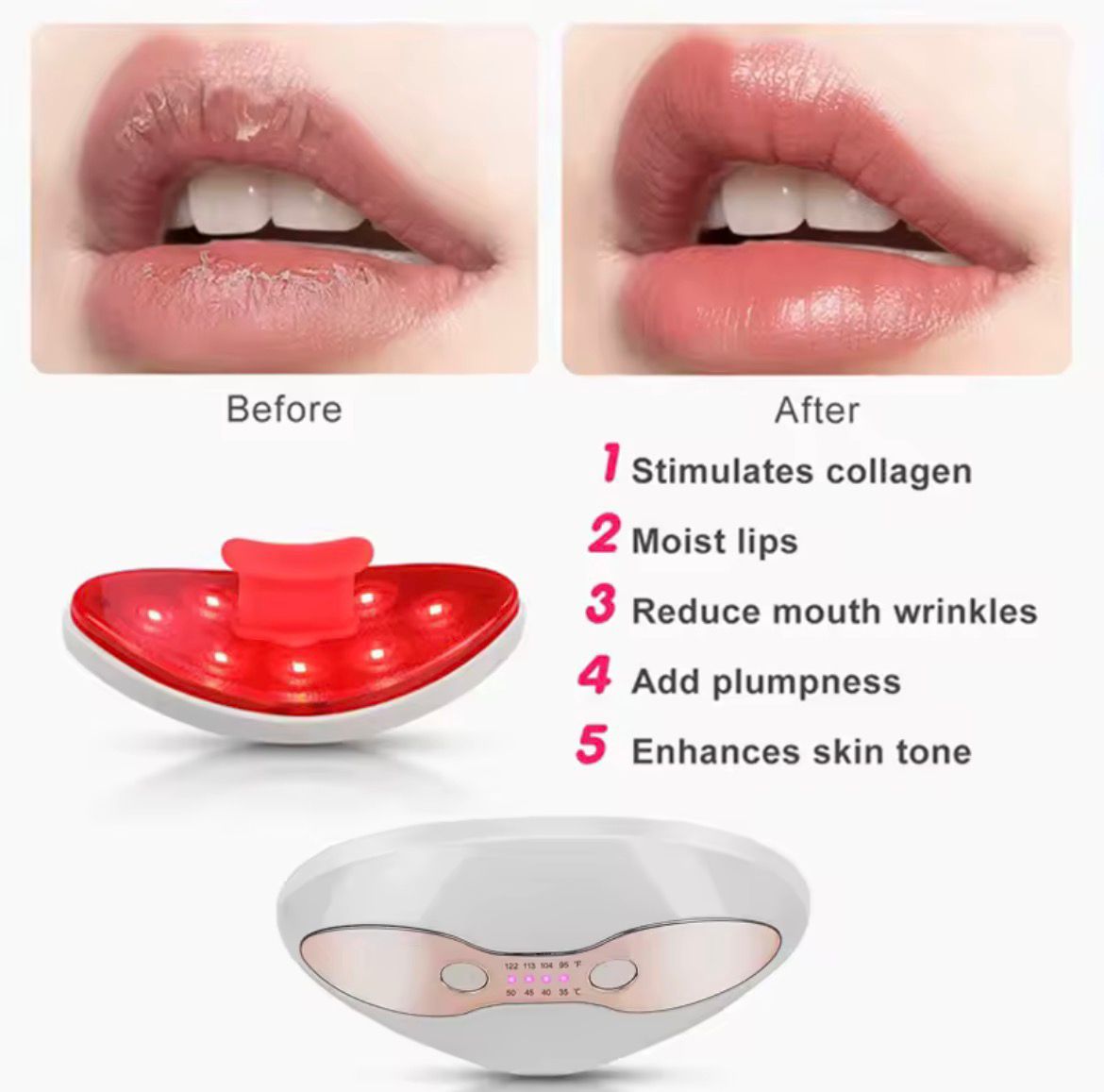 Infrared Light Lip Enriching Device | Electric Collagen‑Enhancing Beauty Tool for Lips and Eyes